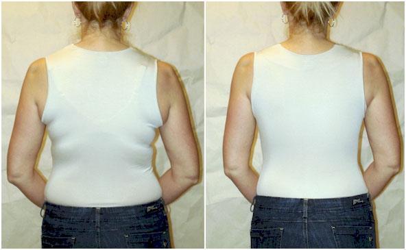 Shapeez All In One Ultimate Back Smoother