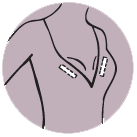 BeConfident Body Tape